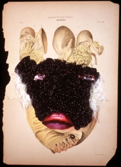 Cancer of the Uterus by Wangechi Mutu